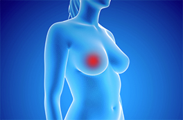 cas_clinique, Diabète et cancer